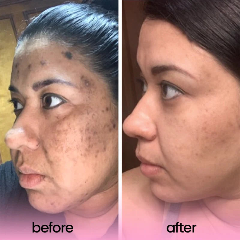 Deep Cleansing Turmeric Acid Pads – Remove Dirt, Oil & Makeup for Radiant Skin
